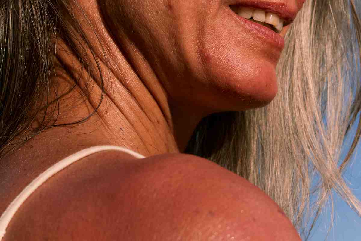précautions prendre au soleil sous Eliquis